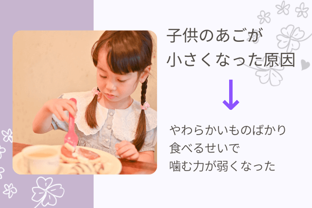 子供のあごが小さくなった原因