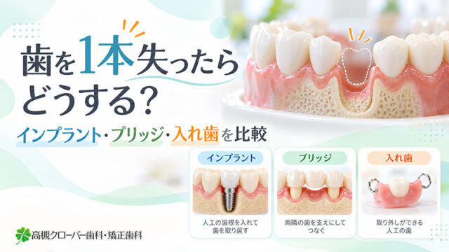 歯を1本失ったらどうする？インプラント・ブリッジ・入れ歯を比較