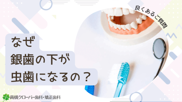 なぜ銀歯の下が虫歯になるの？