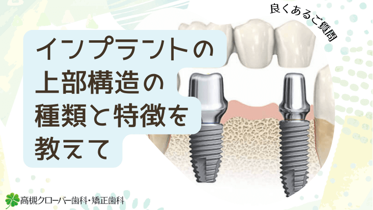 インプラントの上部構造の種類と特徴を教えて