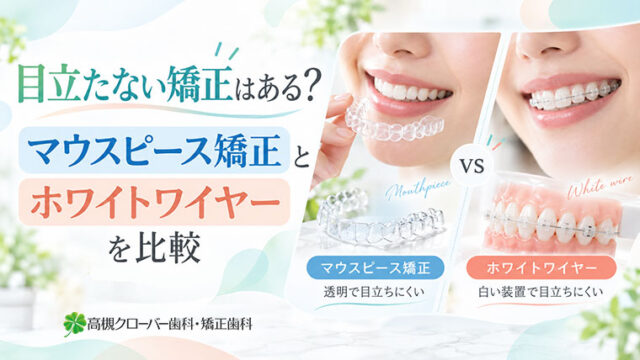 目立たない矯正はある？マウスピース矯正とホワイトワイヤーを比較