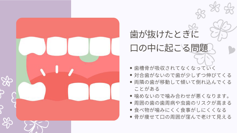 歯が抜けた時に口の中に起こる問題