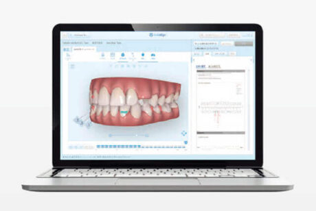 インビザライン　クリンチェック