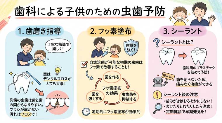 歯科による子供のための虫歯予防の図解