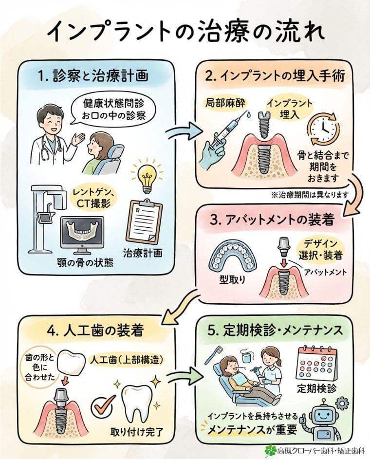 インプラントの治療の流れ