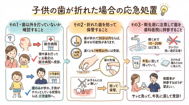子供の歯が折れた場合の応急処置の図解