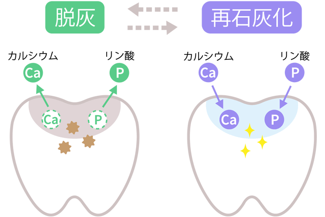 脱灰と再石灰化