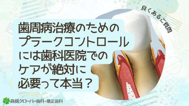 歯周病治療のためのプラークコントロールには歯科医院でのケアが絶対に必要って本当？