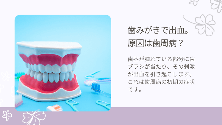 歯磨きで出血。原因は歯周病？