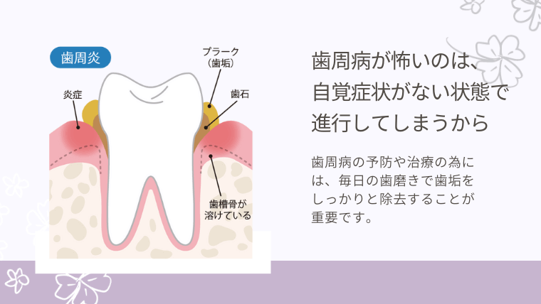 歯周病が怖いのは、自覚症状がない状態で進行してしまうから