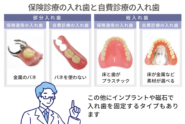 保険の入れ歯と自費診療の入れ歯