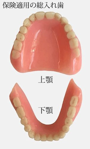 保険適用の総入れ歯