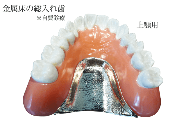 自費診療の金属床の総入れ歯上顎