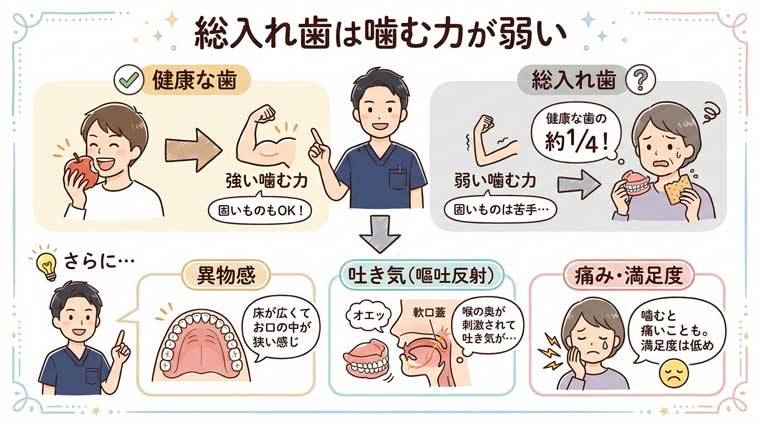 総入れ歯は噛む力が弱いの図解