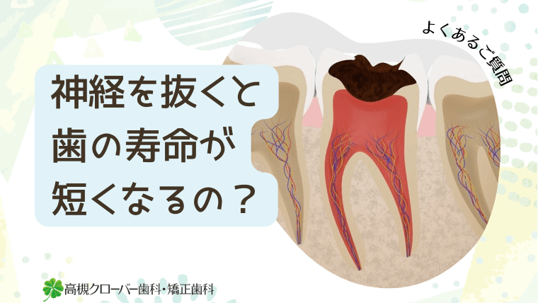 神経を抜くと歯の寿命が短くなるの？