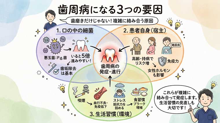 歯周病になる3つの要因の図解