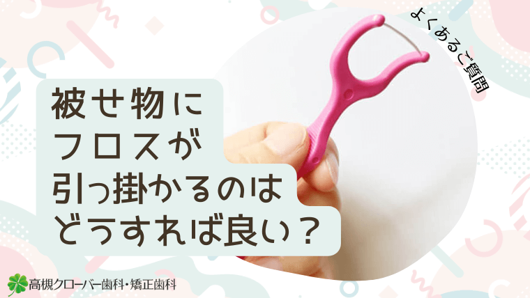 被せ物にフロスが引っ掛かるのはどうすれば良い？