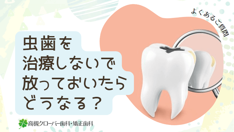 虫歯を治療しないで放っておいたらどうなる？