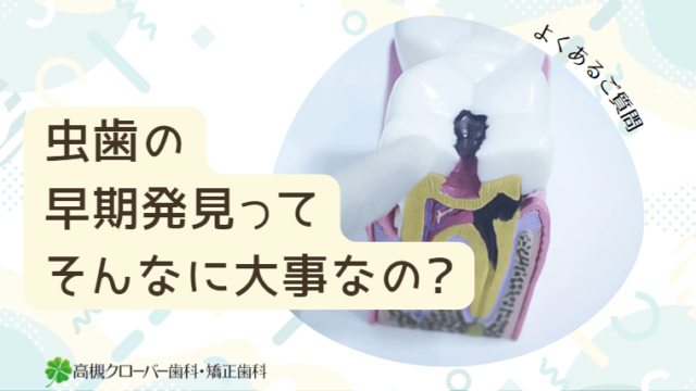 虫歯の早期発見ってそんなに大事なの？