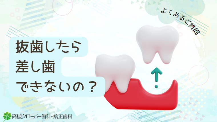 抜歯したら差し歯できないの？