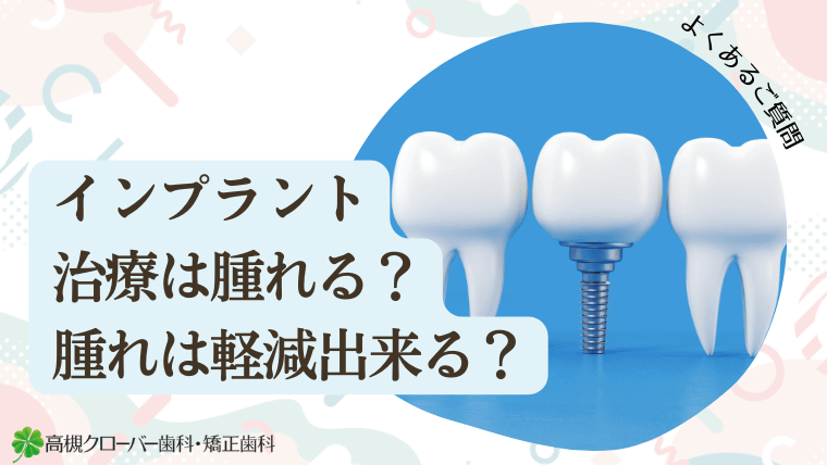 インプラント治療は腫れる？腫れは軽減出来る？