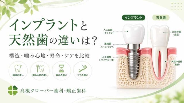 インプラントと天然歯の違いは？構造・噛み心地・寿命・ケアを比較