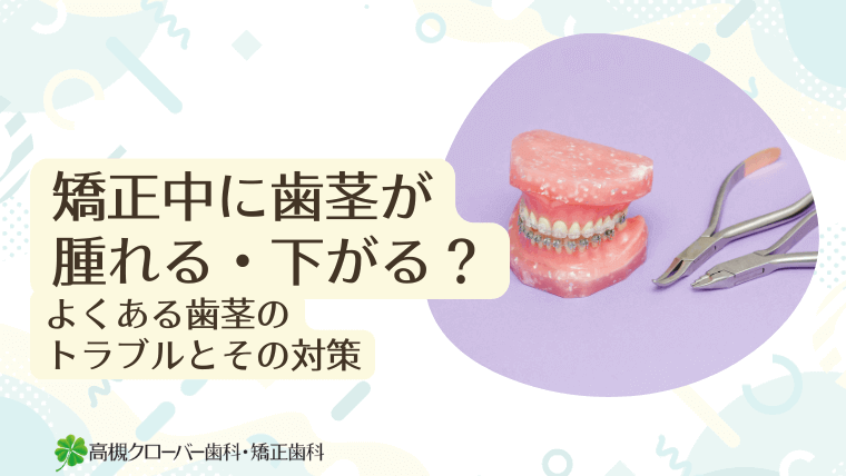 矯正中に歯茎が腫れる・下がる?