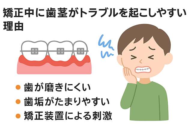 歯茎がトラブルを起こしやすい理由