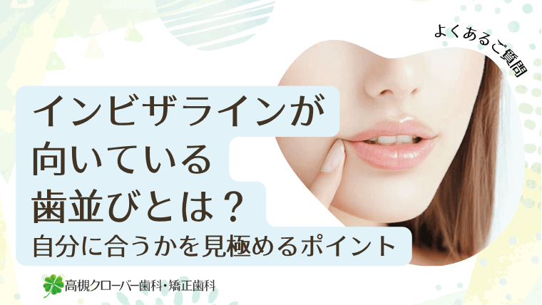 インビザラインが向いている歯並びとは?