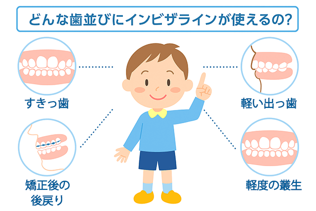 どんな歯並びに使えるの
