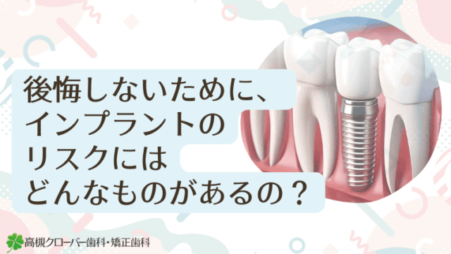 後悔しないために、インプラントのリスクにはどんなものがあるの？