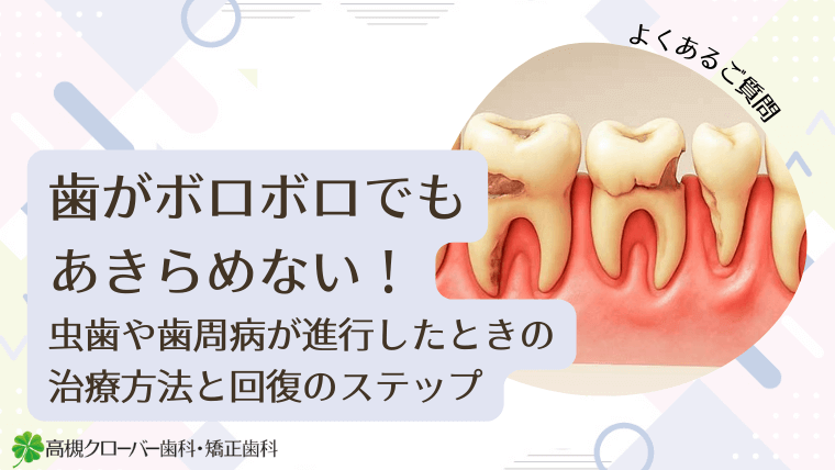 歯がボロボロでもあきらめない！