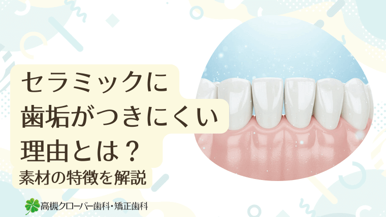 セラミックに歯垢がつきにくい理由とは？
