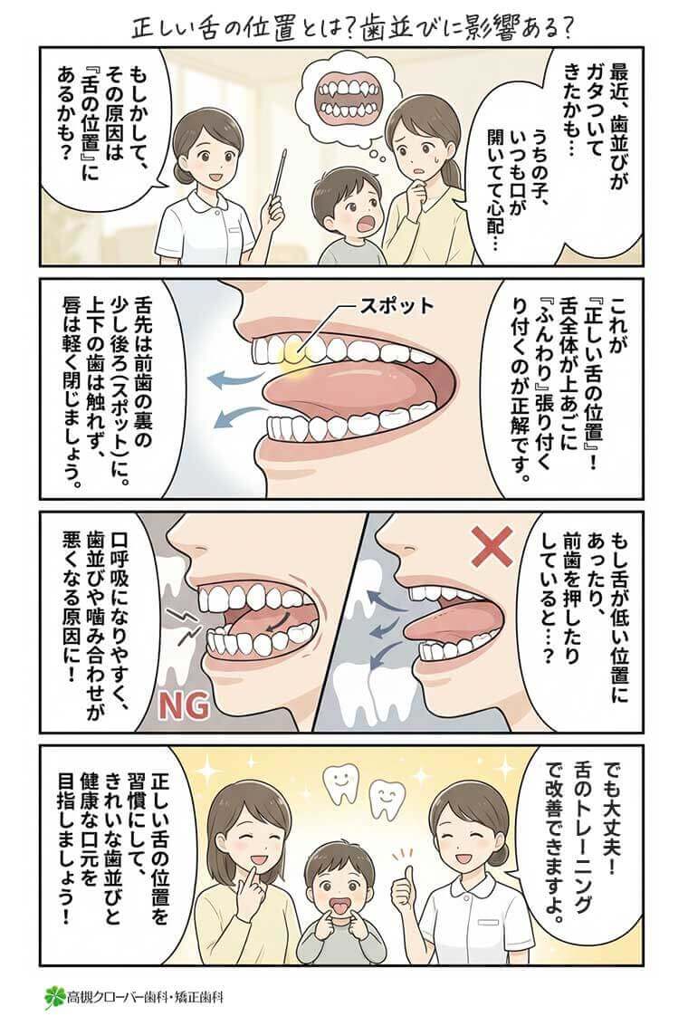 【マンガ】正しい舌の位置とは？歯並びに影響ある？