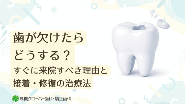 歯が欠けたらどうする？すぐに来院すべき理由と接着・修復の治療法