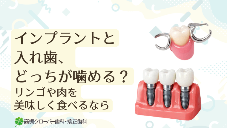 インプラントと入れ歯、どっちが噛める？リンゴや肉を美味しく食べるなら