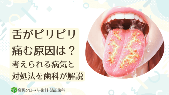 舌がピリピリ痛む原因は？考えられる病気と対処法を歯科が解説