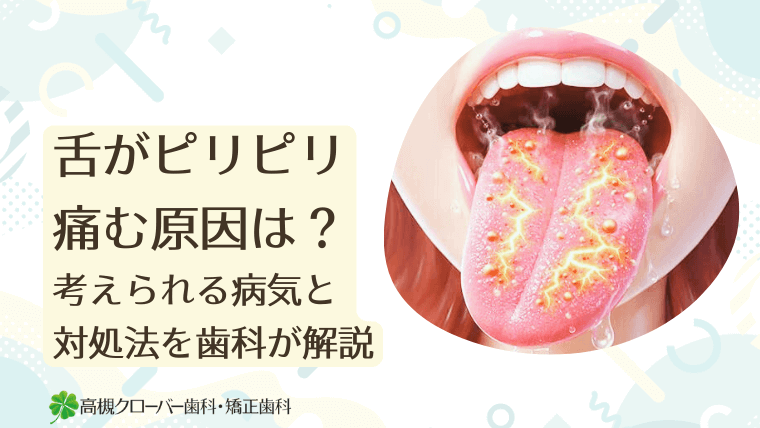 舌がピリピリ痛む原因は？考えられる病気と対処法を歯科が解説