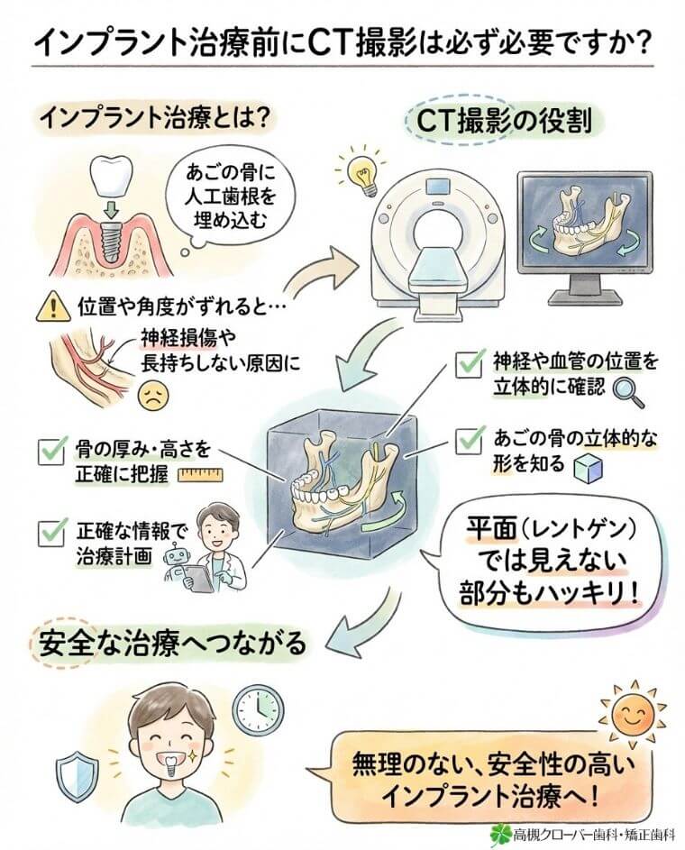 インプラント治療前にCT撮影は必ず必要ですか？
