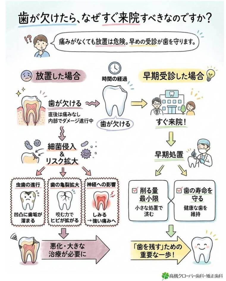 歯が欠けたら、なぜすぐ来院すべきなのですか？