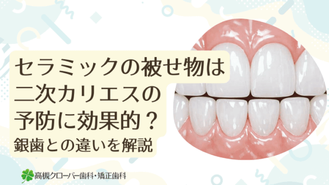 セラミックの被せ物は二次カリエスの予防に効果的？銀歯との違いを解説