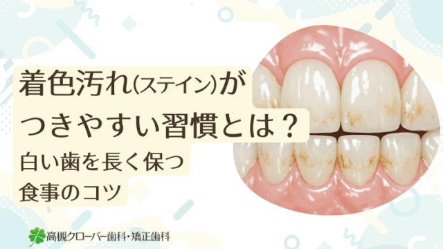 着色汚れ（ステイン）がつきやすい習慣とは？白い歯を長く保つ食事のコツ