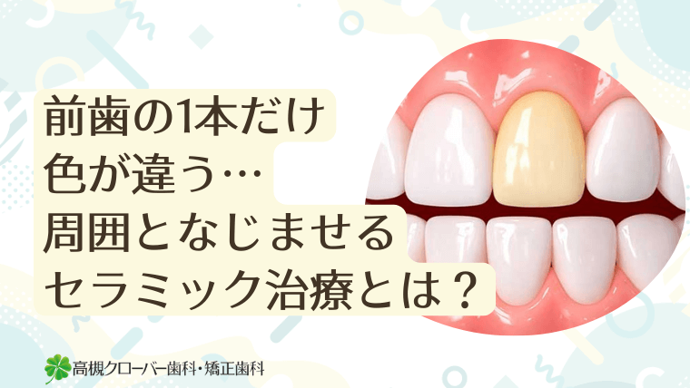 前歯の1本だけ色が違う…周囲となじませるセラミック治療とは？