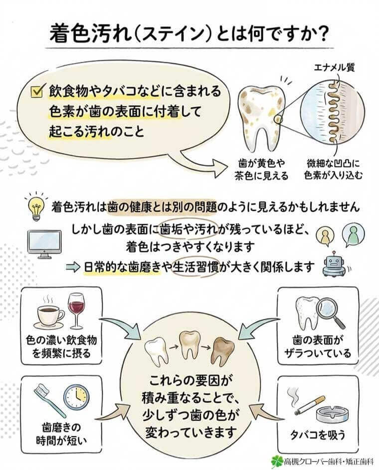 着色汚れ（ステイン）とは何ですか？の図解