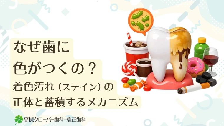 なぜ歯に色がつくの？着色汚れ（ステイン）の正体と蓄積するメカニズム