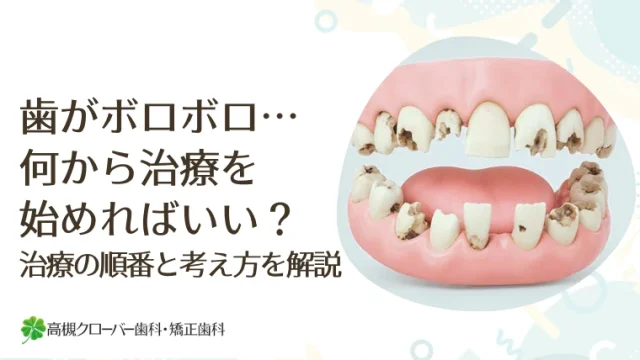 歯がボロボロ…何から治療を始めればいい？治療の順番と考え方を解説
