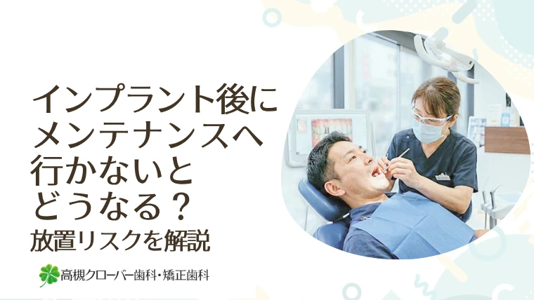インプラント後にメンテナンスへ行かないとどうなる？