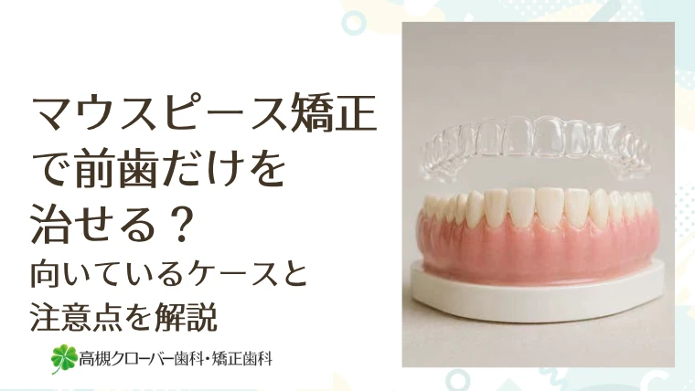 マウスピース矯正で前歯だけを治せる？