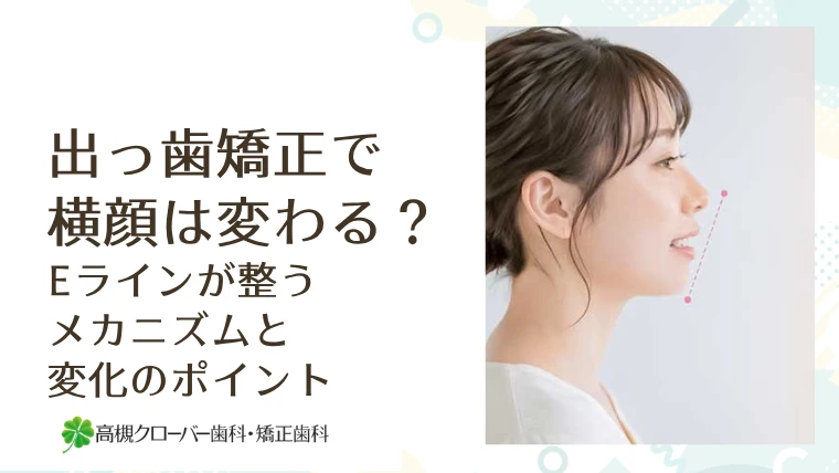 出っ歯矯正で横顔は変わる？Eラインが整うメカニズムと変化のポイント
