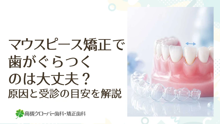 マウスピース矯正で歯がぐらつくのは大丈夫？原因と受診の目安を解説